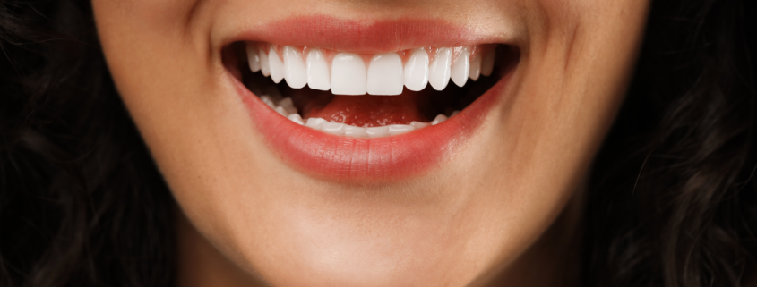 A ortopedia facial é uma área primária da odontologia que vai além da aparência dos dentes. Chamados de perfilistas. Ela foca no crescimento e desenvolvimento dos ossos faciais, garantindo uma harmonia entre função e estética. Na Clínica VRSantos Odontologia na Barra da Tijuca, o Dr. Vinícius Santos utiliza sua vasta experiência para transformar a vida de seus pacientes, oferecendo soluções personalizadas e eficazes.