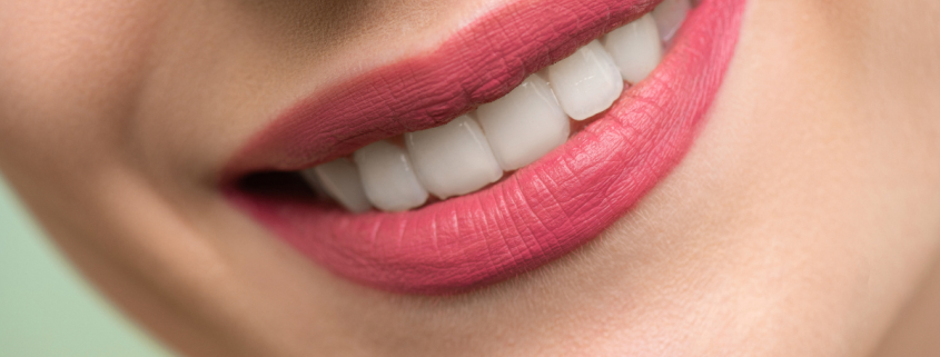 A ortodontia preventiva tem se mostrado uma das ferramentas mais eficazes para garantir sorrisos saudáveis e alinhados ao longo da vida. Se você está buscando uma forma de evitar problemas dentários e melhorar a qualidade de vida bucal de sua família, entender os benefícios da ortodontia preventiva é essencial.