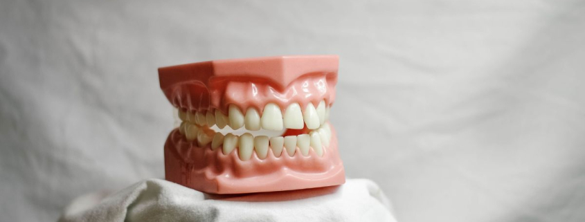 Dentes Tortos Podem Prejudicar Mais do que a Estética: Entenda os Riscos