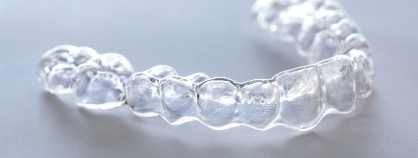 Guia Completo do Invisalign para Adolescentes